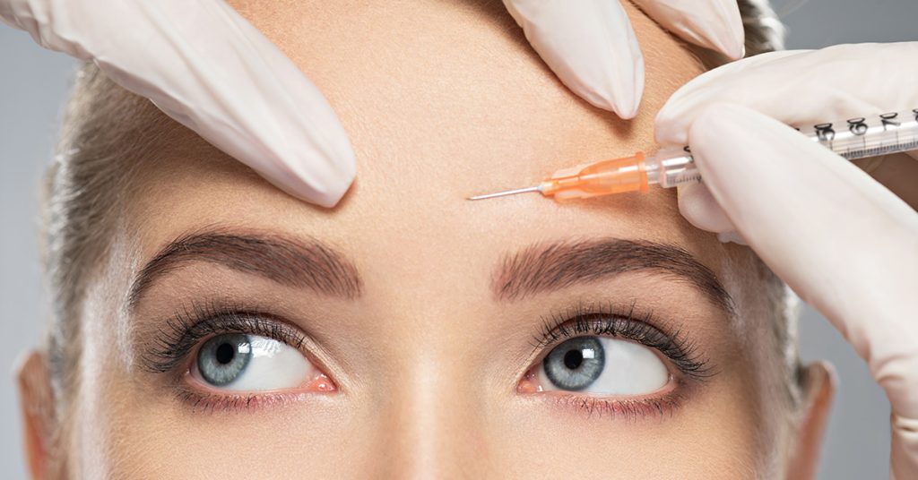 Botox as a Preventive Migraine Option