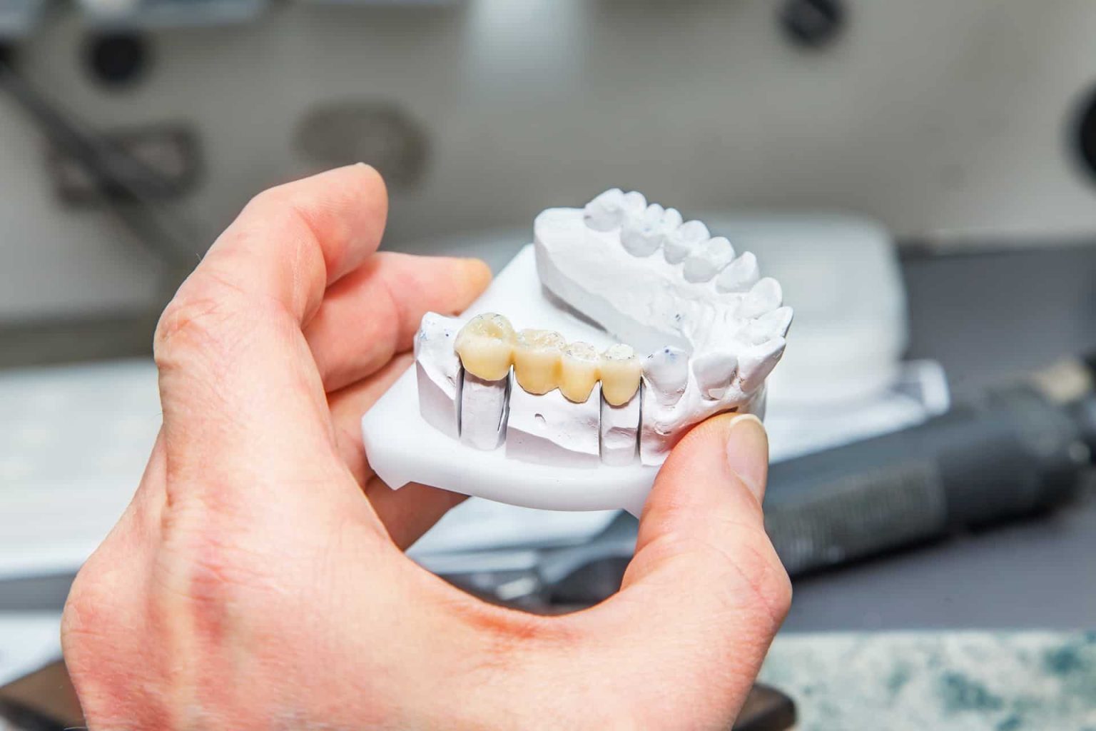 Bridge Solutions for Modern Dentistry
