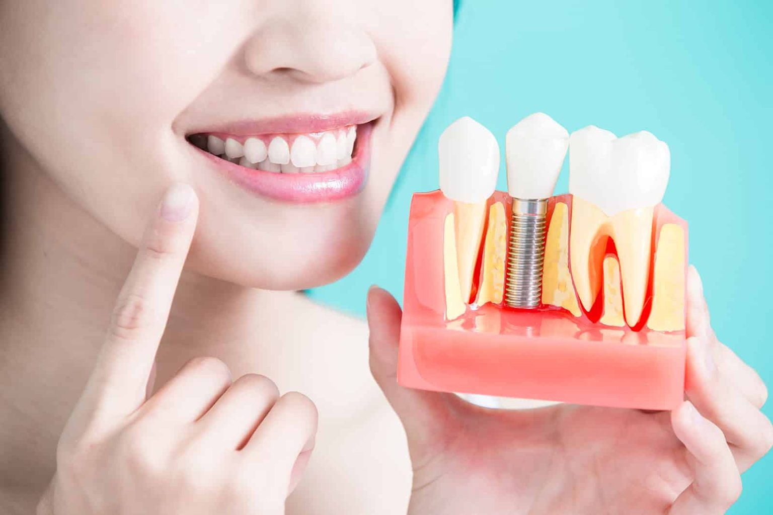 Innovations in Dental Implants