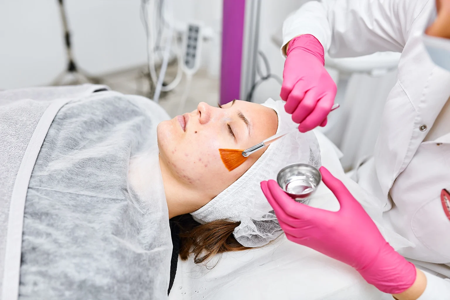 Professional Chemical Peels