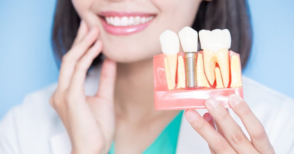 The Impact of Dental Implants on Quality of Life Impact of Dental Implants