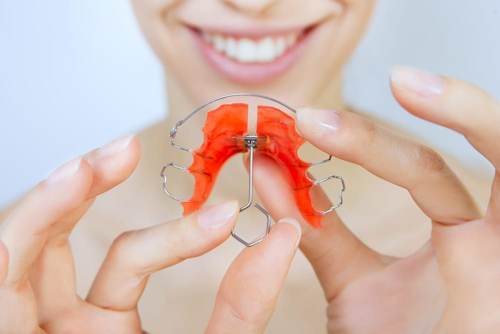 Choosing the Right Type of Retainer for Your Needs Right Type of Retainer