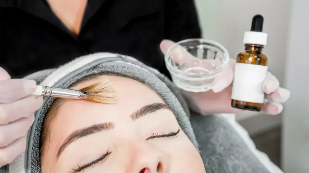 Chemical Peels Works for Skin Rejuvenation