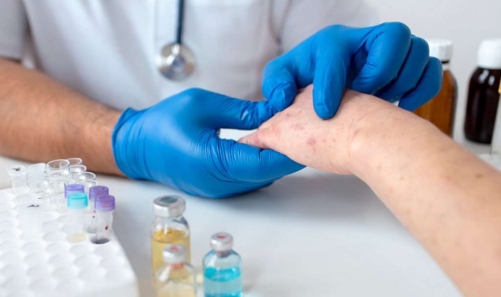 Questions to Ask During Your Consultation With an Allergist Consultation With an Allergist