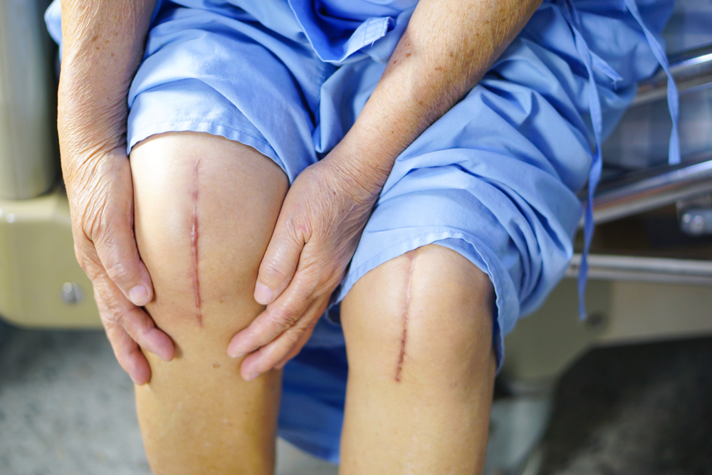 Pain Management Techniques for Post-Surgical Recovery Post-Surgical Recovery