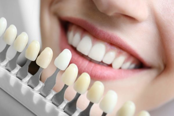 The Process of Picking Veneers in Cosmetic Dentistry Veneers